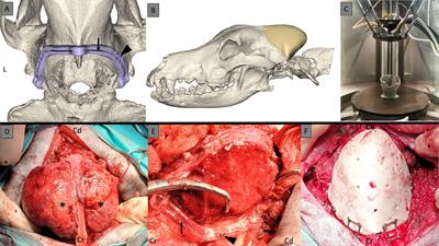 Case report: One-stage craniectomy and cranioplasty digital workflow for three-dimensional printed polyetheretherketone implant for an extensive skull multilobular osteochondosarcoma in a dog